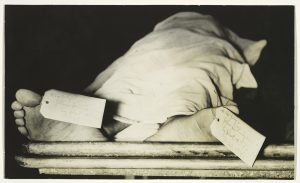8. John Dillinger's Feet, Chicago Morgue-300